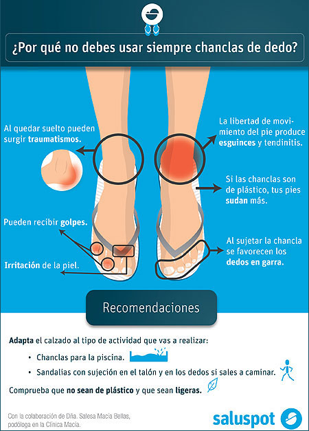 Chanclas en Verano