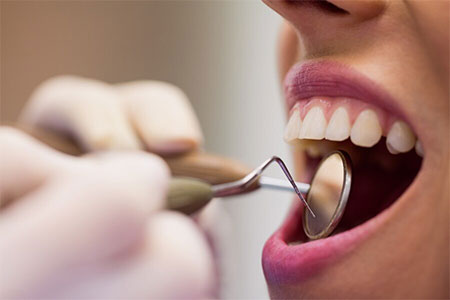 Beneficios de ir a una clínica dental profesional